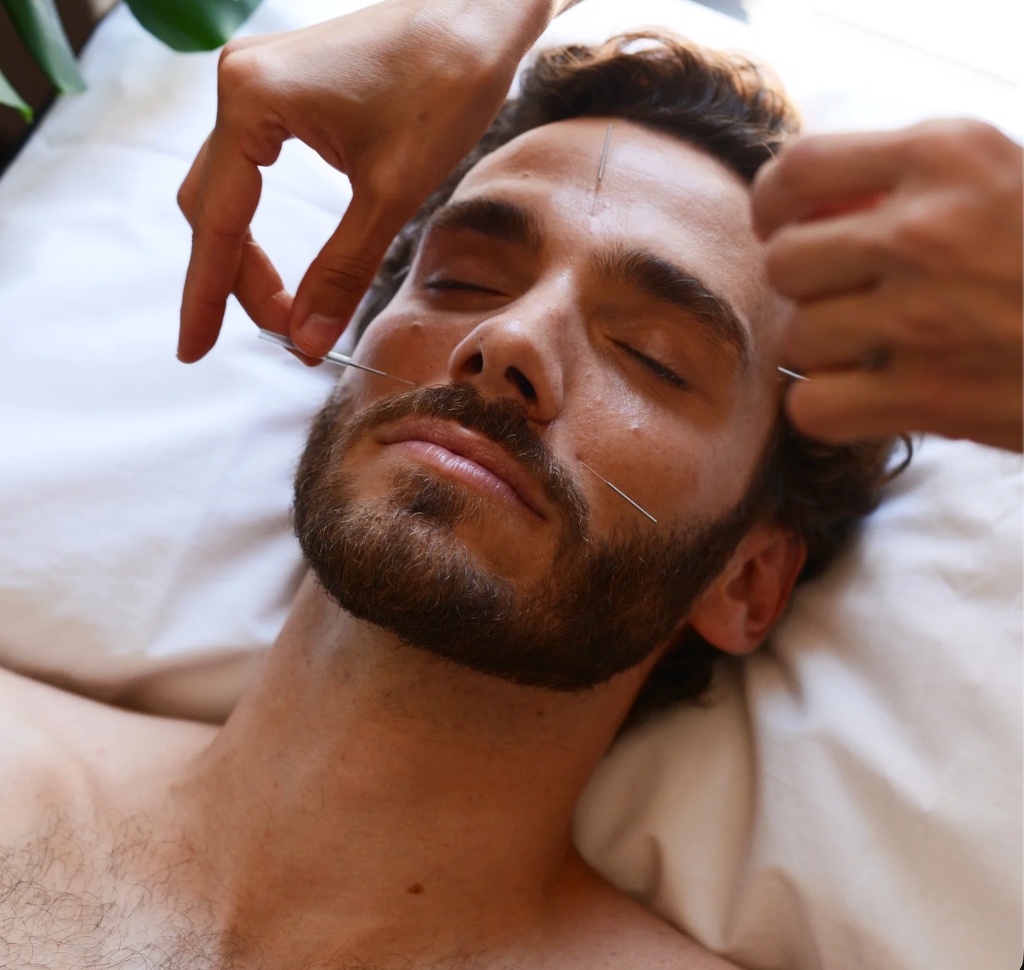 Body + Mind Acupuncture Treatment